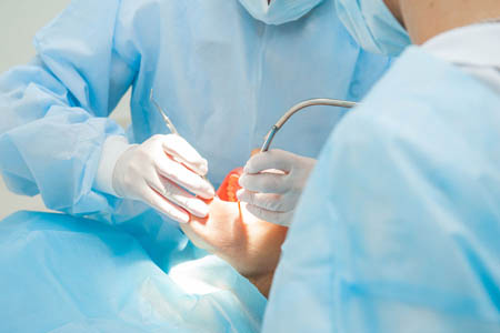 What To Expect from Oral Surgery